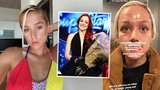 SuperStar Emma Drobná po požití léků: Okamžitý převoz na pohotovost! Co se stalo?