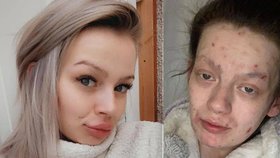 Demi-Nicole Dunlopová (27) překonala těžkou závislost na tvrdých drogách.