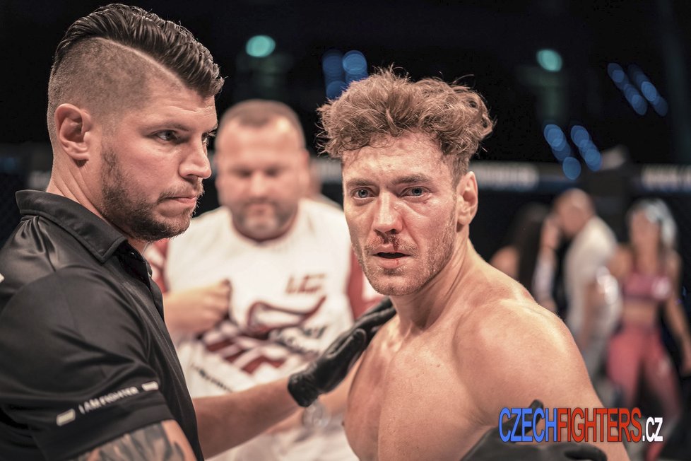 Miroslavu Dubovickému bude ještě dlouho připomínat první souboj v MMA jeho nos