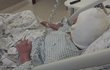 Stav nejvíce popáleného horníka po důlním neštěstí, ke kterému došlo 20. prosince 2018, je už dobrý. Muž brzy opustí nemocnici. Stav nejvíce popáleného horníka po důlním neštěstí, ke kterému došlo 20. prosince 2018, je už dobrý. Muž brzy opustí nemocnici.