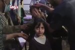 Přeživší po útoku v syrském městě Dúmá v péči lékařů