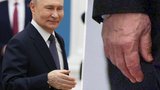 Putin uprostřed nových zvěstí o zdraví: Oteklá ruka s vypouklými žilami!