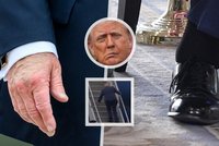 Letošní zdravotní trable Trumpa: Oteklé kotníky, modřiny, kulhání... i „povislá“ tvář