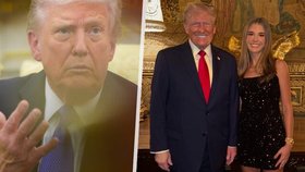 Trump má zase modřinu. A vnučka Kai propálila informaci o prezidentově problému.