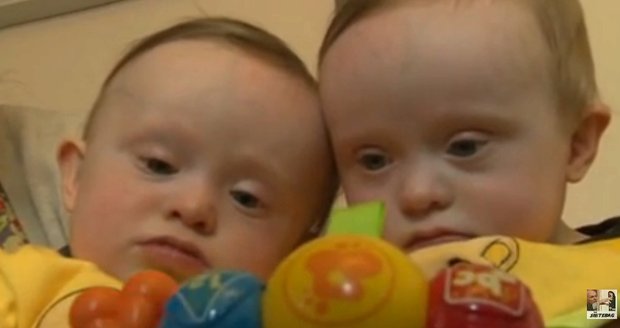 Arthur a Alfie jsou jedněmi z milionu dvojčat, která se narodila s Downovým syndromem.