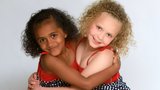 Neuvěřitelná hrátka přírody! Dvojčata black & white budí rozruch, na vině jsou smíšené geny