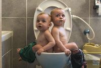 Genetické zjištění: Jednovaječná dvojčata nejsou identická, DNA jim mění mutace