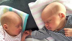 Jednovaječná dvojčata odlišného pohlaví překvapila australské vědce (ilustrační foto).