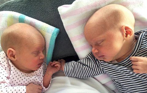Extrémně vzácná dvojčata šokují lékaře: Mají „zázračnou“ DNA!