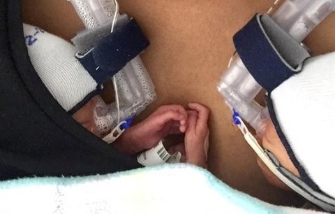 Tohle vás rozpláče: Předčasně narozená dvojčata se stále drží za ručičku!
