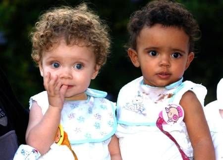 Dívkám lidé nevěří, že jsou skutečnými dvojčaty.