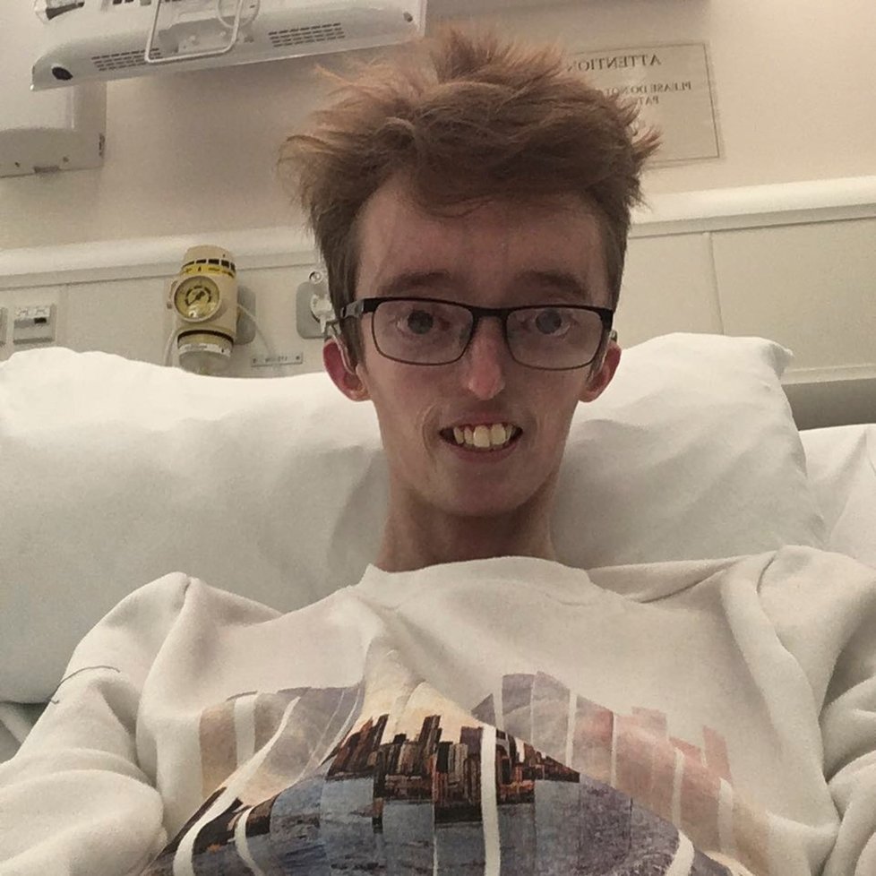 Dylan Lombard (18) trpí vzácným onemocněním.