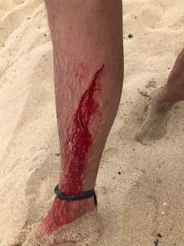 Dylana na Havaji napadl žralok.