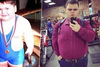 Zemřelo nejtlustší dítě světa: Obézní mladík se dožil pouhých 21 let!