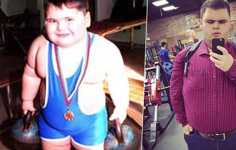 Zemřelo nejtlustší dítě světa: Obézní mladík se dožil pouhých 21 let!