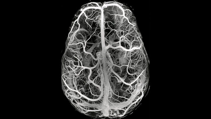 Čip Synchronu počítá s opravou nebo rozšířením činnosti mozku. Použije k tomu cévy, které zásobují mozek krví.