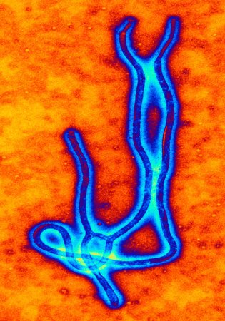 (Ilustrační foto) Tak vypadá zvětšený virus eboly.