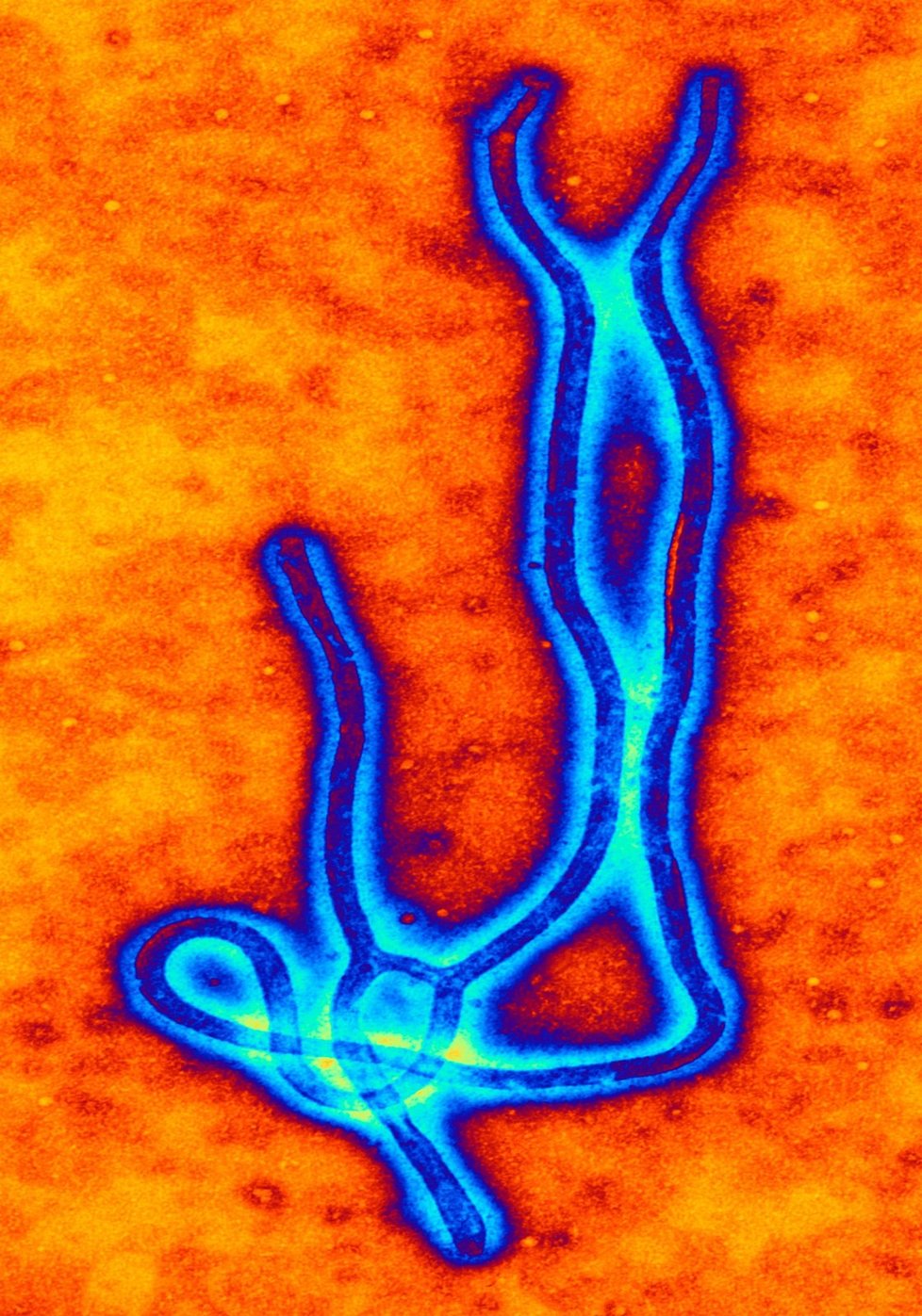 Tak vypadá zvětšený virus eboly.