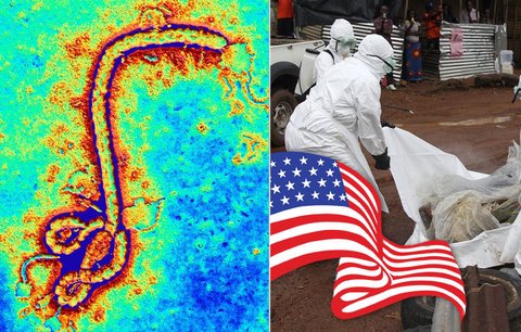 Američan s ebolou cestoval přes Brusel: Kolik dalších nakazil?!