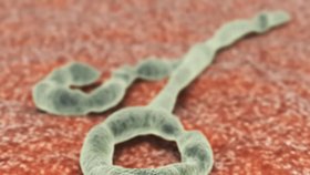 Takhle vypadá virus ebola. Virová vlákna jsou obvykle tvarována do mnoha podob, včetně podoby „U“, „6“, svinuté podoby nebo i tzv. rozvětvené podoby.