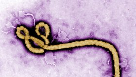Takhle vypadá zákeřný virus eboly.