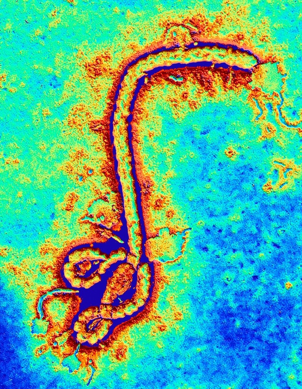 Virus ebola se šíří v západní Africe. Doposud nebyla vynalezena žádná vakcína, která by před nákazou uchránila.