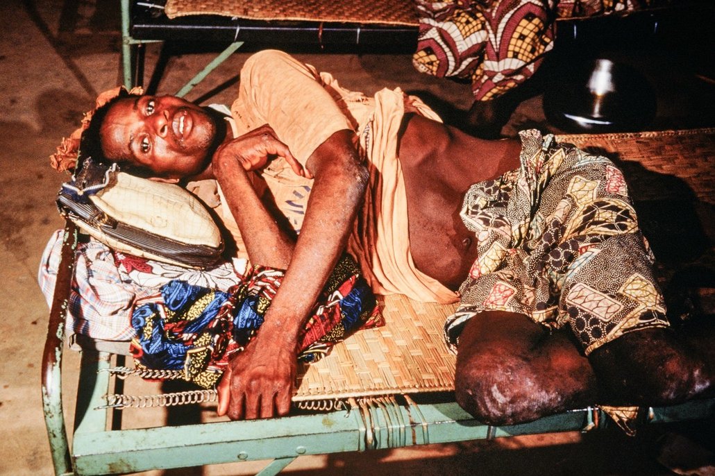 Ebola je jednou z nejnebezpečnějších chorob na světě. Je vysoce nakažlivá a může zabít až 90 % nemocných. Virus ebola byl poprvé zjištěn během propuknutí krvácivé horečky v Zairu (dnešní Demokratické republice Kongo) v roce 1976.