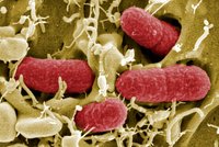 Nová verze smrtící bakterie EHEC na Slovensku