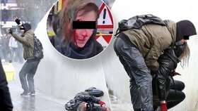 V několika nizozemských městech se protestovalo proti vládním opatřením v boji s koronavirem. Češka Denisa Š. po zásahu vodním dělem utrpěla zranění hlavy.