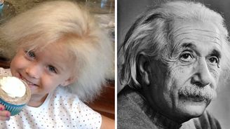 Vlasy jako Einstein: Holčička trpí vzácnou genovou mutací nekompatibilních vlasů