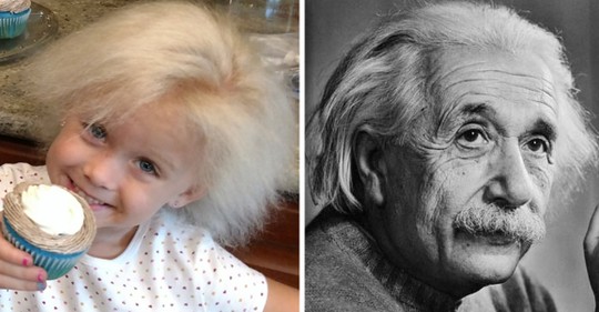 Vlasy jako Einstein: Holčička trpí vzácnou genovou mutací nekompatibilních vlasů