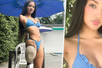 Victoria přišla při strašném úrazu o ruce a nohu: I přesto je z ní krásná modelka!