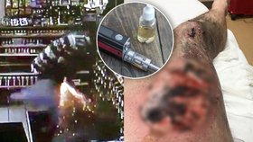 Muži na benzince bouchla elektronická cigareta v kapse: Utržil popáleniny druhého stupně
