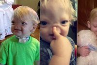 Statečný Eli (†2) trpěl vzácnou nemocí: Narodil se bez nosu, boj o svůj život prohrál
