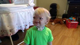 Malý Eli se narodil se vzácnou nemocí. Svůj boj po dvou letech prohrál.