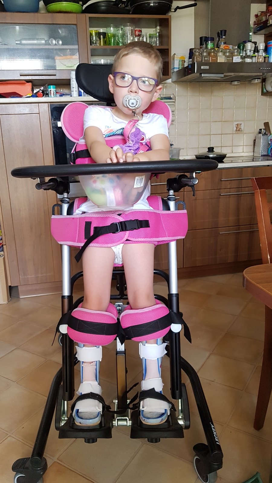 Eliška Novotná (6) trpí vzácným syndromem