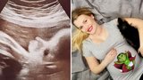 Těhotná muzikálová kráska konečně ukázala ultrazvuk: Takhle vypadá její princezna!