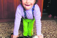 Eliška (3) trpí vzácnou vadou: Pošlete jí svůj vzkaz!