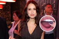 Elizabeth Kopecká smutní: Ulomila si kousek zubu!