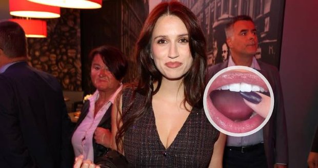 Elizabeth Kopecká si zažila trápení kvůli zubu