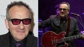 Elvis Costello zrušil turné: Po operaci nádoru stále není ve formě
