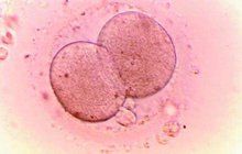 Skandál na brněnské klinice: Ženám zaměnili embrya!