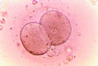 Exkluzivně: Dvěma ženám zaměnili na české klinice embrya při umělém oplodnění