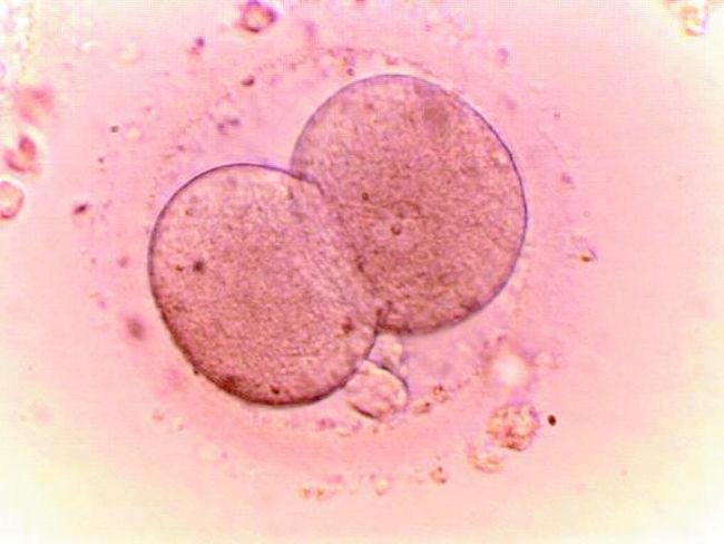 První případ v Česku: Dvěma ženám zaměnili embrya.