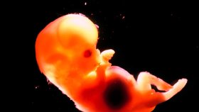 Embryo je agresivní, chce prostě přežít