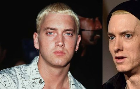 Závislák Eminem: Léky na předpis mu vypálily díru do žaludku