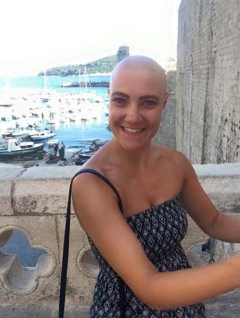 Emma přišla o vlasy kvůli nemoci alopecii.