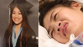 Emmalyn Nguyenová (18) prodělala infarkt při zvětšování ňader.