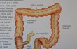 Nejvíc »bijí do očí« prohozené popisky u obrázku tlustého střeva. Podle nich vede ze slepého střeva konečník.