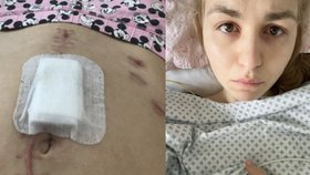 Tělo Margit (28) nezvládá operace: Bříško plné jizev a boje na hranici smrti